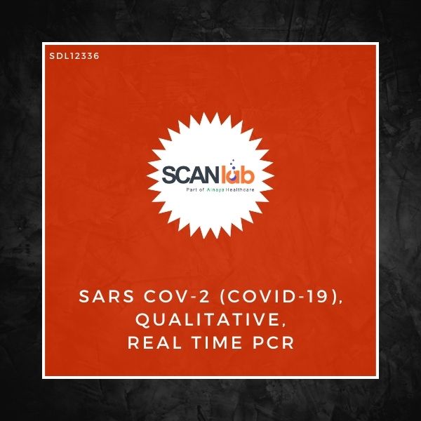 SARS COV-2 (COVID-19) QUALITATIVE REAL TIME PCR (SDL12336)