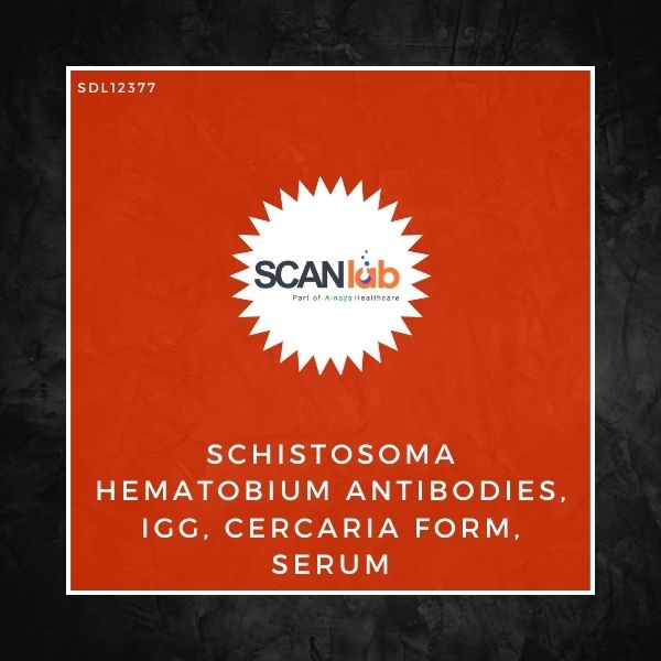 SCHISTOSOMA HEMATOBIUM ANTIBODIES, IGG, CERCARIA FORM, SERUM (SDL12377)