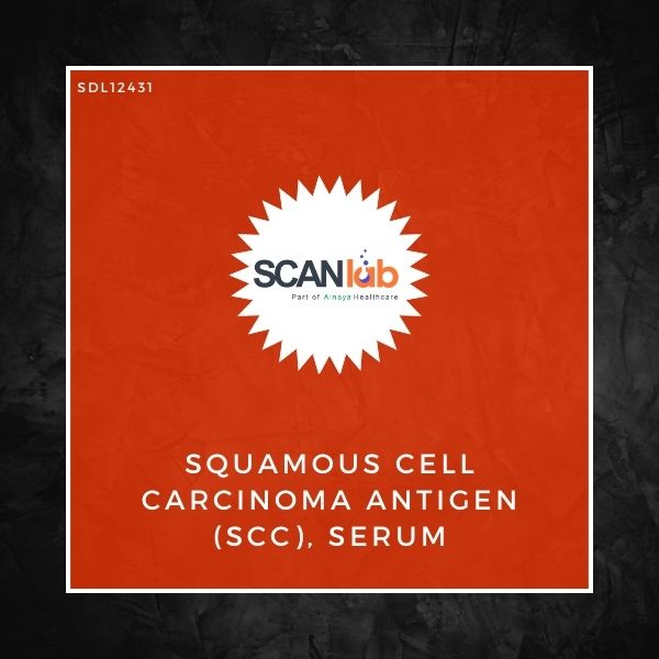 SQUAMOUS CELL CARCINOMA ANTIGEN (SCC), SERUM (SDL12431)