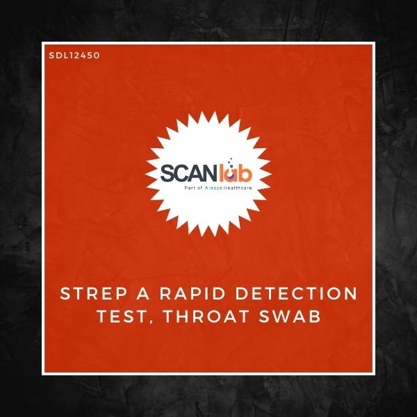 STREP A RAPID DETECTION TEST, THROAT SWAB (SDL12450)