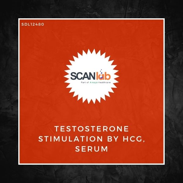 TESTOSTERONE STIMULATION BY HCG, SERUM (SDL12480)