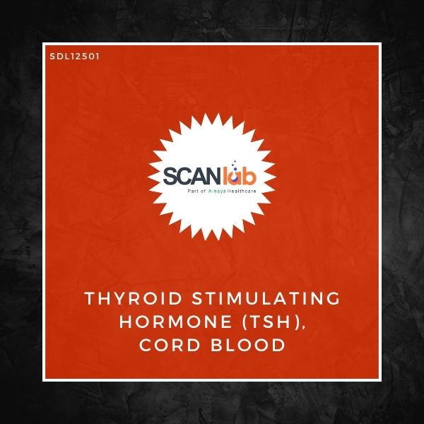 THYROID STIMULATING HORMONE (TSH), CORD BLOOD (SDL12501)