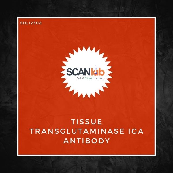 TISSUE TRANSGLUTAMINASE (TTG) IGA ANTIBODY (SDL12508)