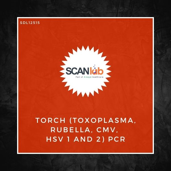 TORCH (TOXOPLASMA RUBELLA CMV HSV 1 AND 2) PCR (SDL12515)