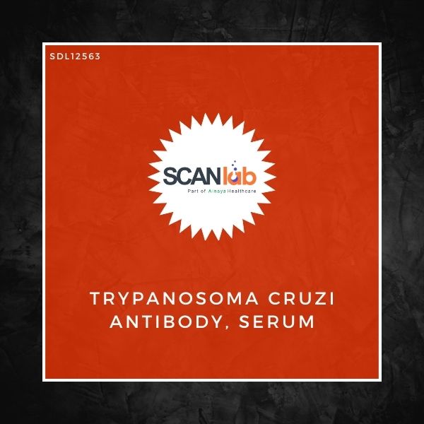 TRYPANOSOMA CRUZI ANTIBODY, SERUM (SDL12563)