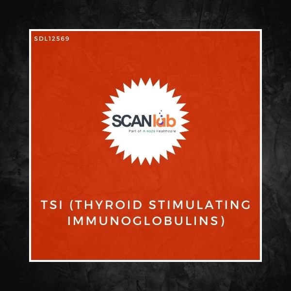 TSI (THYROID STIMULATING IMMUNOGLOBULINS) (SDL12569)