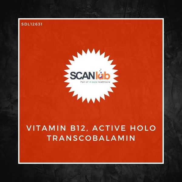 VITAMIN B12, ACTIVE HOLO TRANSCOBALAMIN (SDL12631)