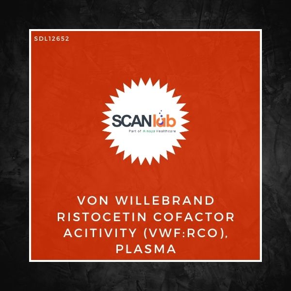 VON WILLEBRAND RISTOCETIN COFACTOR ACITIVITY (VWF:RCO), PLASMA (SDL12652)