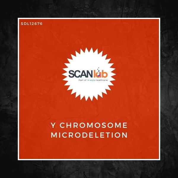 Y CHROMOSOME MICRODELETION (SDL12676)