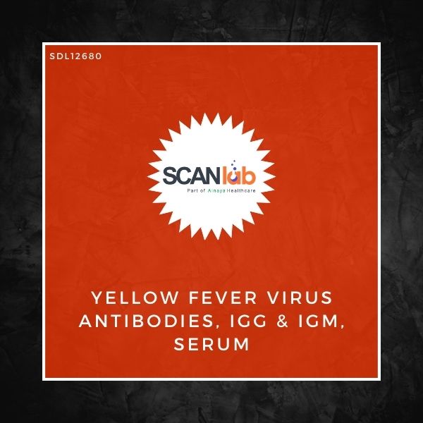 YELLOW FEVER VIRUS ANTIBODIES, IGG & IGM, SERUM (SDL12680)