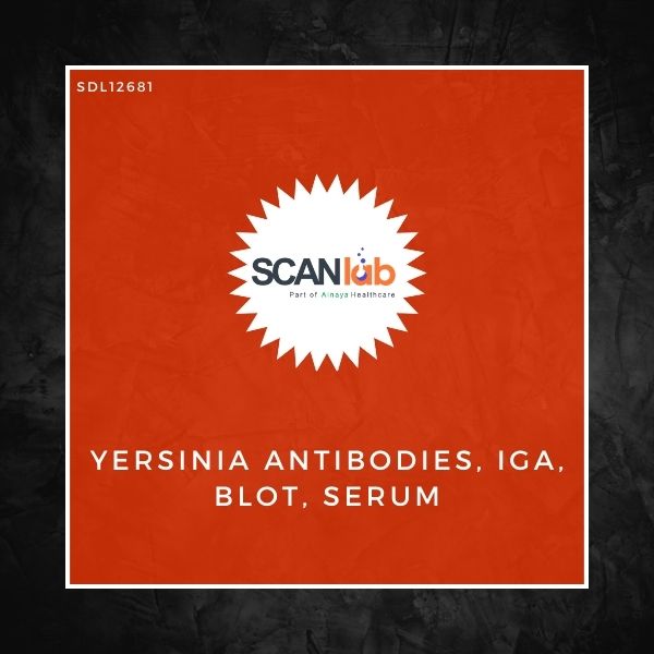 YERSINIA ANTIBODIES, IGA, BLOT, SERUM (SDL12681)