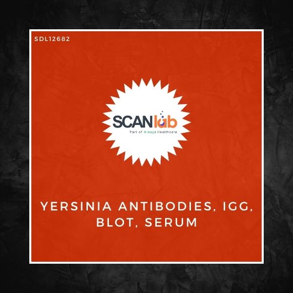 YERSINIA ANTIBODIES, IGG, BLOT, SERUM (SDL12682)