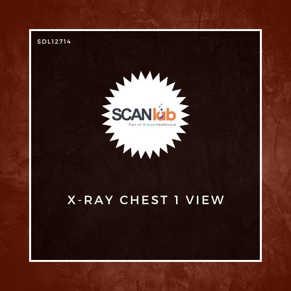 X-RAY CHEST 1 VIEW (SDL12714)
