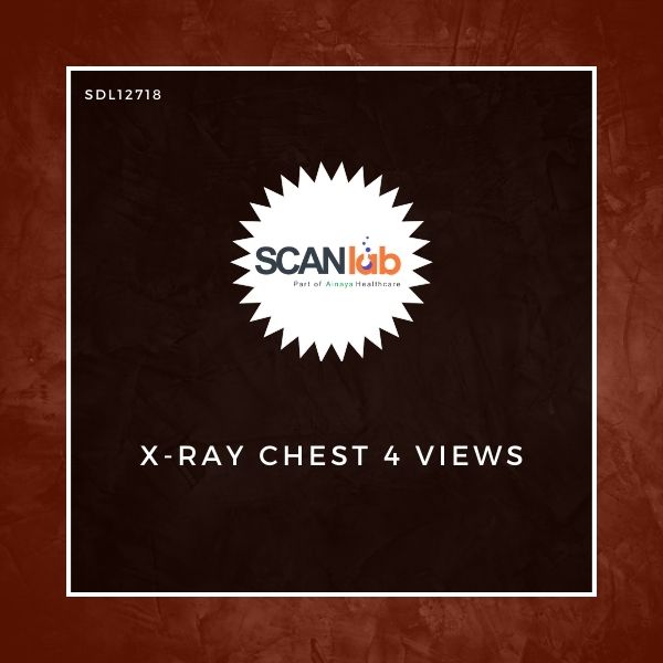 X-RAY CHEST 4 VIEWS (SDL12718)
