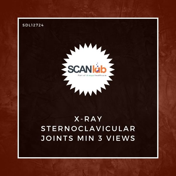X-RAY STERNOCLAVICULAR JOINTS MIN 3 VIEWS (SDL12724)