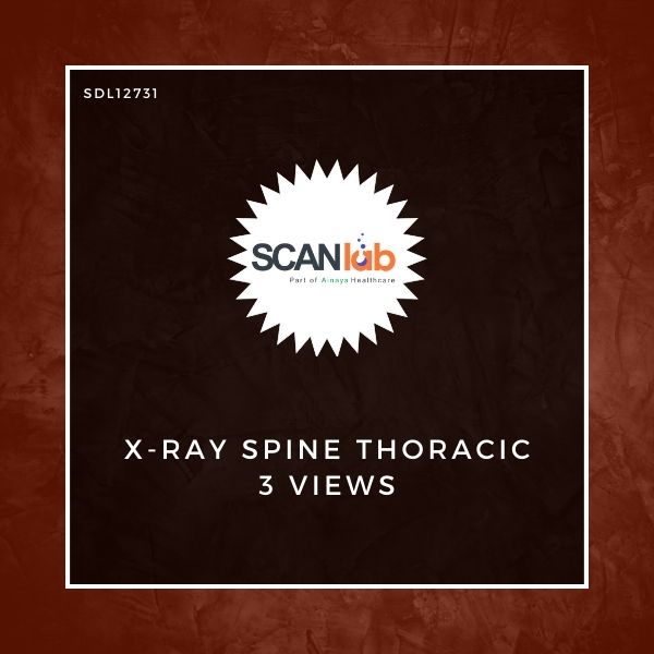 X-RAY SPINE THORACIC 3 VIEWS (SDL12731)