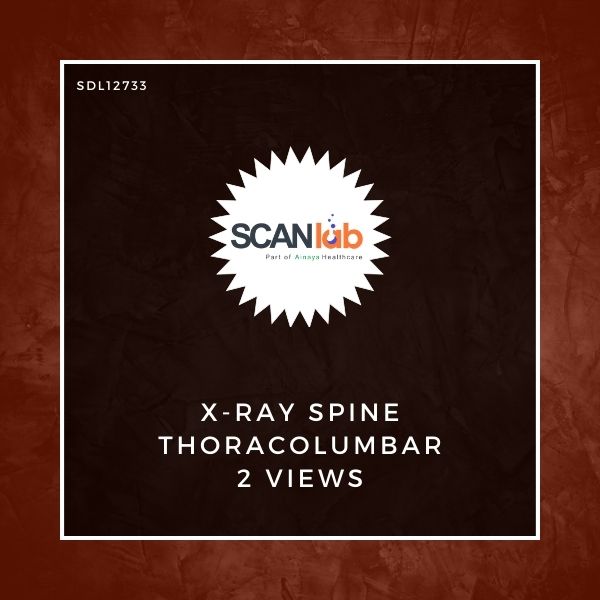 X-RAY SPINE THORACOLUMBAR 2 VIEWS (SDL12733)