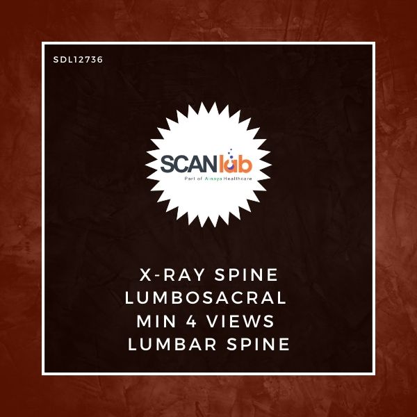 X-RAY SPINE LUMBOSACRAL MIN 4 VIEWS LUMBAR SPINE (SDL12736)