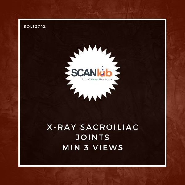 X-RAY SACROILIAC JOINTS MIN 3 VIEWS (SDL12742)