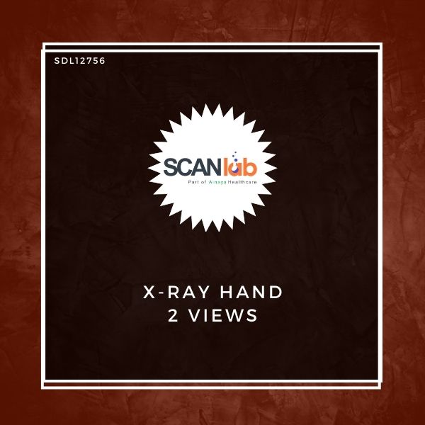 X-RAY HAND 2 VIEWS (SDL12756)