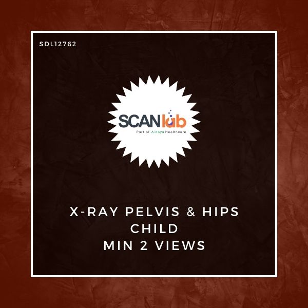 X-RAY PELVIS & HIPS CHILD MIN 2 VIEWS (SDL12762)