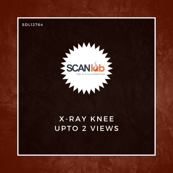 X-RAY KNEE UPTO 2 VIEWS (SDL12764)