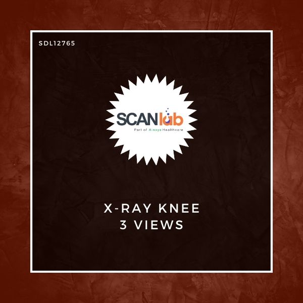 X-RAY KNEE 3 VIEWS (SDL12765)