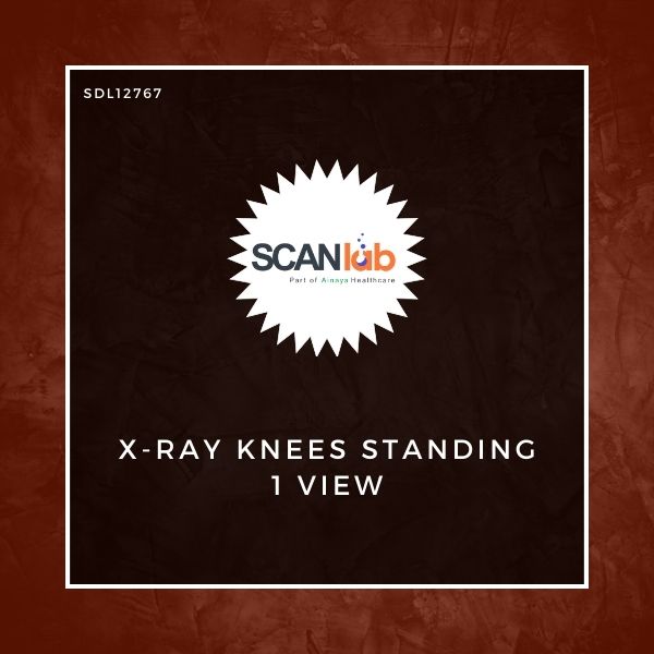 X-RAY KNEES STANDING 1 VIEW (SDL12767)