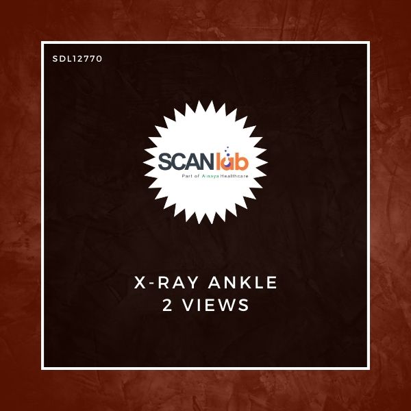 X-RAY ANKLE 2 VIEWS (SDL12770)