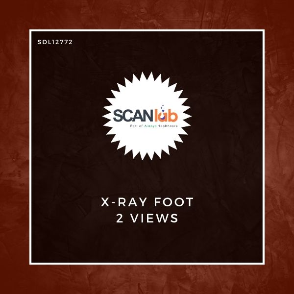 X-RAY FOOT 2 VIEWS (SDL12772)