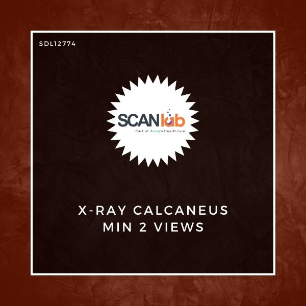 X-RAY CALCANEUS MIN 2 VIEWS (SDL12774)