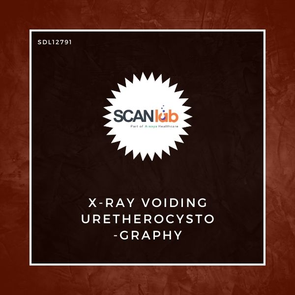 X-RAY VOIDING URETHEROCYSTOGRAPHY (SDL12791)
