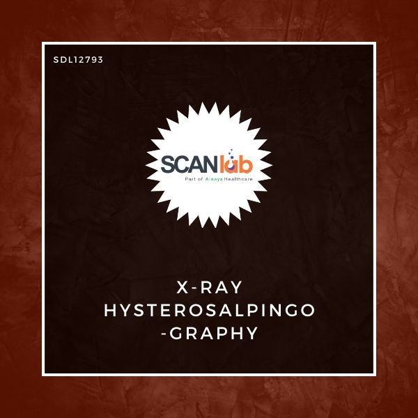 X-RAY HYSTEROSALPINGOGRAPHY (SDL12793)