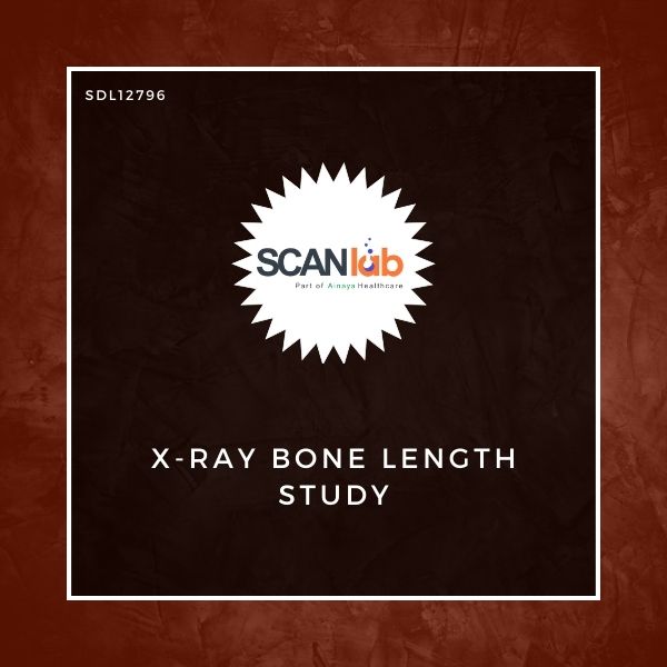 X-RAY BONE LENGTH STUDY (SDL12796)