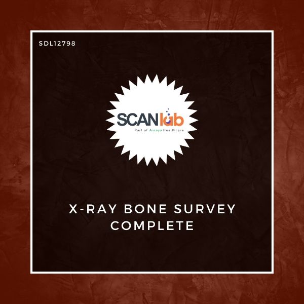 X-RAY BONE SURVEY COMPLETE (SDL12798)