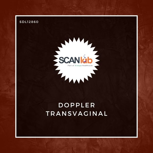 DOPPLER TRANSVAGINAL (SDL12860)