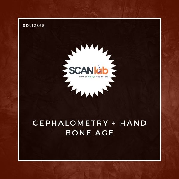 CEPHALOMETRY+HAND BONE AGE (SDL12865)