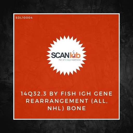 [SDL10004] 14Q32.3 BY FISH IGH GENE REARRANGEMENT (ALL, NHL) BONE (SDL10004)