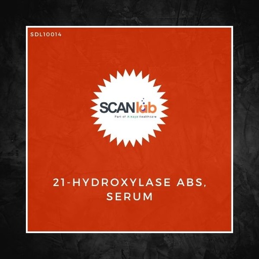 [SDL10014] 21-HYDROXYLASE ABS, SERUM (SDL10014)