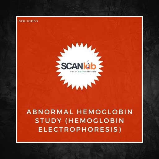 [SDL10033] ABNORMAL HEMOGLOBIN STUDY (HEMOGLOBIN ELECTROPHORESIS) (SDL10033)