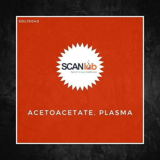[SDL10040] ACETOACETATE, PLASMA (SDL10040)