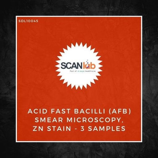 [SDL10045] ACID FAST BACILLI (AFB) SMEAR MICROSCOPY, ZN STAIN-3 SAMPLES (SDL10045)