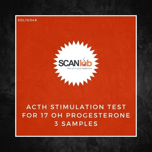 [SDL10048] ACTH STIMULATION TEST FOR 17 OH PROGESTERONE 3 SAMPLES (SDL10048)