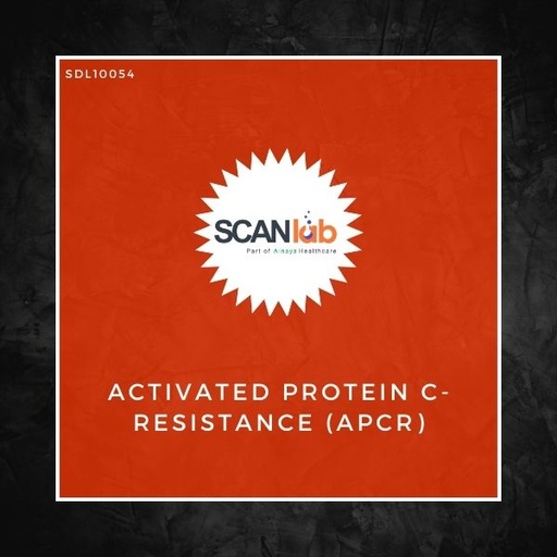 [SDL10054] ACTIVATED PROTEIN C-RESISTANCE (APCR) (SDL10054)