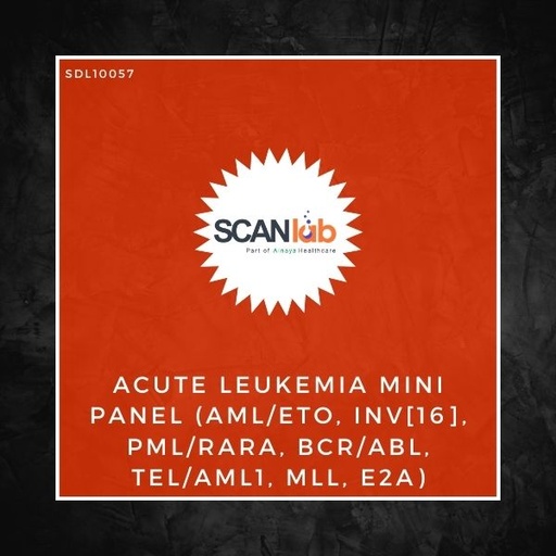 [SDL10057] ACUTE LEUKEMIA MINI PANEL (AML/ETO, INV[16], PML/RARA, BCR/ABL, TEL/AML1, MLL, E2A) (SDL10057)