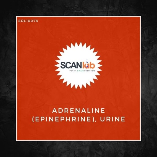 [SDL10078] ADRENALINE (EPINEPHRINE), URINE (SDL10078)