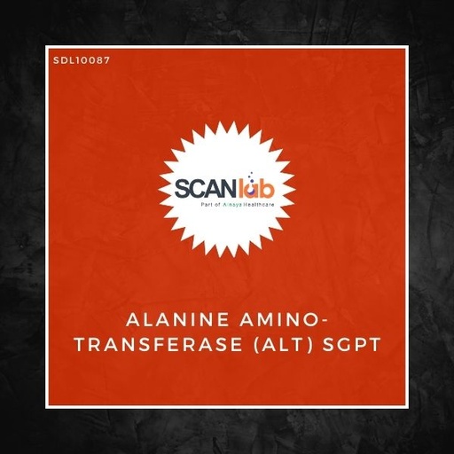 [SDL10087] ALANINE AMINO-TRANSFERASE (ALT) SGPT (SDL10087)