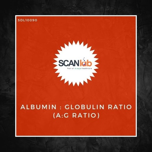 [SDL10090] ALBUMIN : GLOBULIN RATIO (A:G RATIO) (SDL10090)