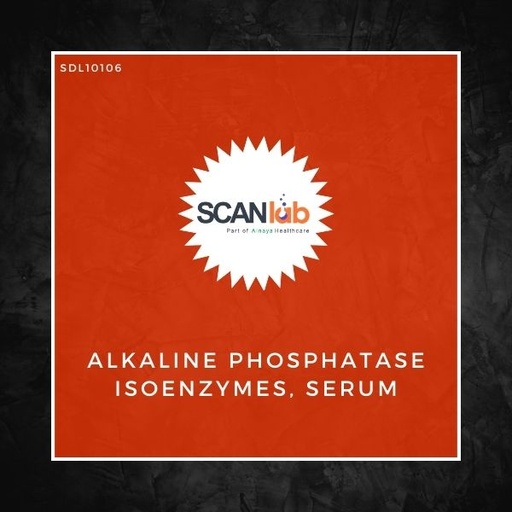 [SDL10106] ALKALINE PHOSPHATASE ISOENZYMES, SERUM (SDL10106)