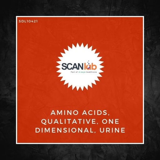 [SDL10421] AMINO ACIDS, QUALITATIVE, ONE DIMENSIONAL, URINE (SDL10421)